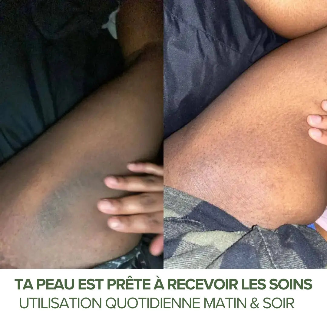 Kit Résultats Rapides — 3 Produits