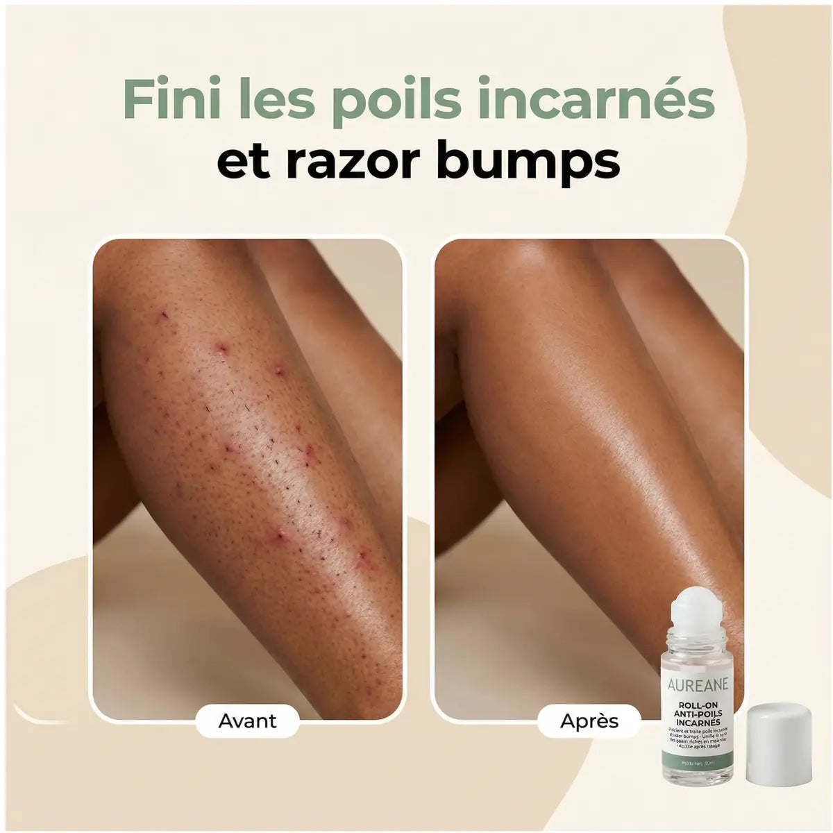 Roll-On Anti-Poils Incarnés